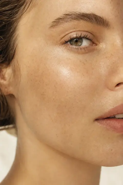 Laser Skin Resurfacing at Luxe Skin Glasgow